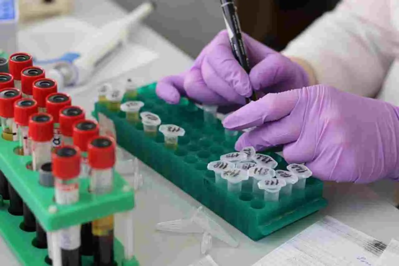 Addio ai test gratuiti cresce la preoccupazione per le infezioni cosa succede adesso Immagine selezionata